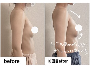 つばききよら/１０回でボリュームアップ！