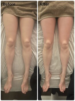 エニ 恵比寿(eni)/脚のビフォーアフター