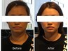 【大人気No. 1☆】顔歪み&巻肩改善で”-1cm実感！小顔首巻肩矯正☆50分¥3,800