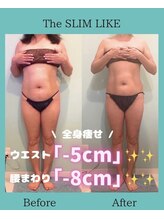 スリムライク 鳥取店(The SLIM LIKE)/痩身ビフォーアフター