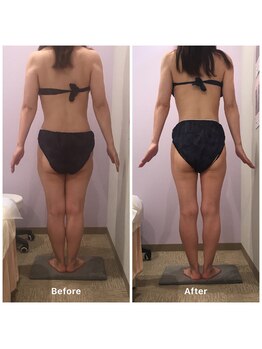 ナレル(narrel)/(新潟市/骨盤/痩身/ダイエット)