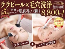 ロータスマップ(LOTUS MAP)