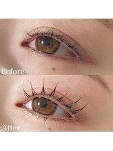 レピア 郡山駅前店/韓国式LEPIA Before&After