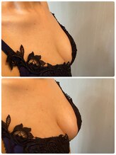 スマイルクルー(SmileClue)/初回ビフォーアフター症例