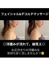 シュ シュ(chou chou)/フェイシャルデコルテマッサージ