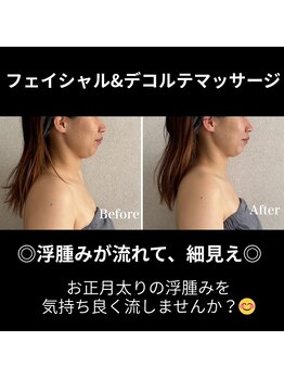 シュ シュ(chou chou)/フェイシャルデコルテマッサージ