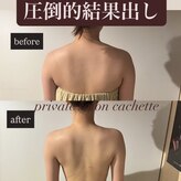 カシェット(cachette)