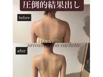 カシェット(cachette)の写真