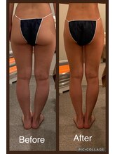 いおり骨盤整体 リブート(RE:BOOT)/セレクト痩身