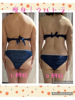 サロン ド スー(Salon de Suu)/ウルトランスフォーマー