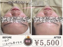 マヴィ くずは店(MavY.)/リフトアップ×ツヤ