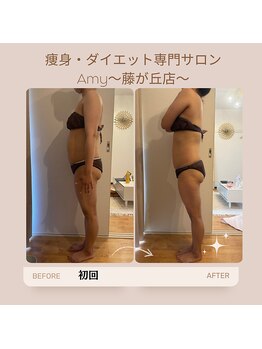 エイミー 藤ヶ丘店(Amy)/before→after