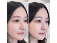 アンドアルファ 神戸三宮(&α)/美眉/眉毛/アイブロウ/神戸三宮