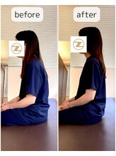ゼン骨盤整体院(ZEN骨盤整体院)/【30代女性】産後腰痛/肩こり