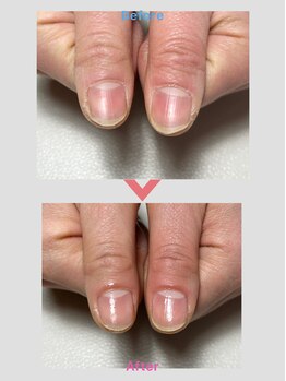 ワイ(Y)/ネイルケア