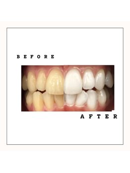 セルフダック 会津若松店(SELFDUCK)/BeforeAfter