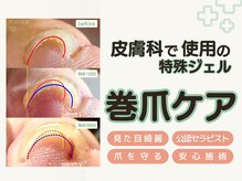 エラック 大阪本店(ERAC)の雰囲気(結果を出す!無理なく爪に負担かけない)