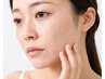 【乾燥肌、肌荒れ】 慢性肌トラブル改善