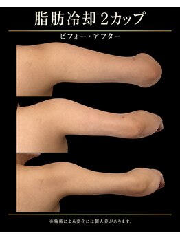 アンドミー(&mii)の写真/何をしても痩せない！引き締めたい、無理なく痩せたい方はぜひお試しください★