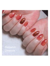 トレジャー(treasure)/