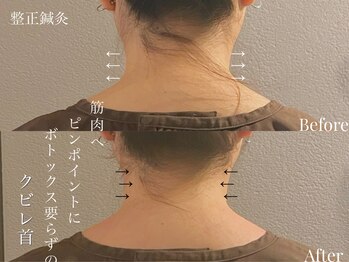 ボー(BeAu)/Before After ♪