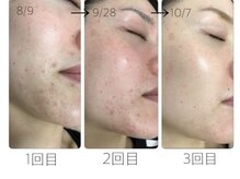 スリリアン 銀座/★お客さまビフォーアフター★