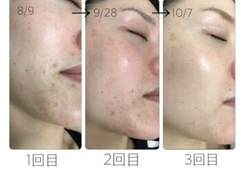 スリリアン 銀座/★お客さまビフォーアフター★