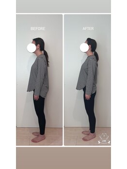 ビーラボ(Be Lab)/全身矯正 施術Before→After