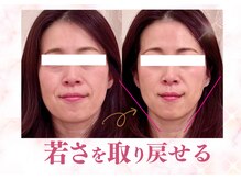 ローズモモの雰囲気（★本気で小顔・リフトアップを求める方へ結果重視の小顔矯正です）