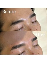 モテテ(motete)/お客様施術例☆栄本店