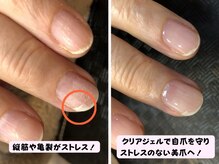 ココネイル(coco.nail)/爪の亀裂はジェルで解消できます