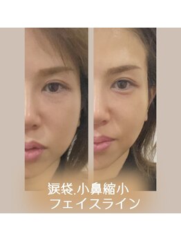 ナナイロ(nanairo)/ポテンツァ×エクソソーム