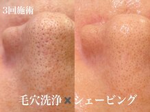 エンソワー(en'sower)