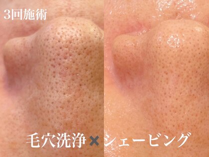 エンソワー(en'sower)の写真