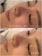 エルビウ(ELBIU)の写真/《よもぎ蒸し×肌質改善》身体の内側から温め、巡りを整えた後にフェイシャルケアでお肌の改善を◇