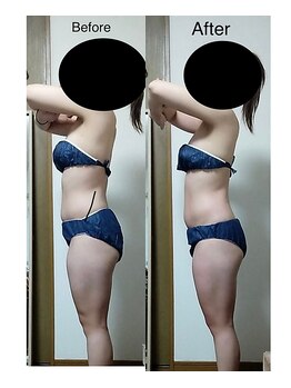 ナチュラルライフ(Natural Life)/施術のbefore after．3