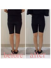 スタイルラボ高松/産後骨盤矯正の効果♪