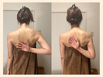 ラフリー 西宮北口院(RUFFREE)/肩甲骨はがしで背中美人