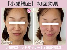 アンリエッタ(Unlieta)/まずはお顔の土台を整えましょう