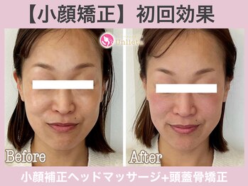 アンリエッタ(Unlieta)/まずはお顔の土台を整えましょう