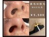 【鼻毛スッキリ】鼻毛 W 脱毛 (ワックス＆光)  ¥ 5,500