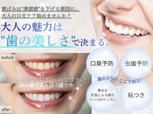 ホワイトニングショップ 福岡香椎店