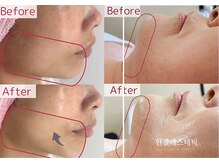 PB/レッドショット