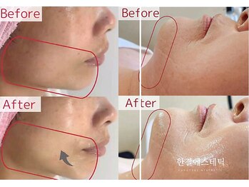 PB/レッドショット