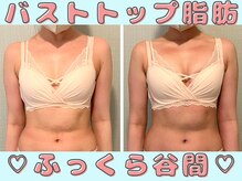 プレフィール(PLEAFEEL)/姿勢矯正バストアップ