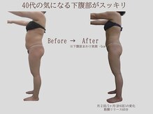 プレリー 自由が丘店/40代のきになる下腹部がスッキリ