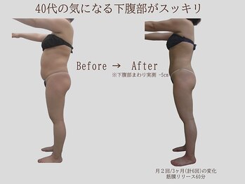 プレリー 自由が丘店/40代のきになる下腹部がスッキリ