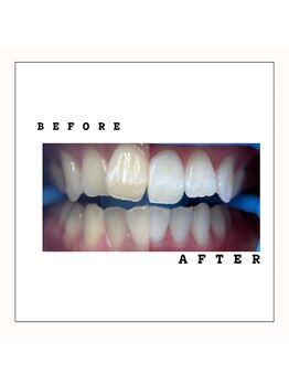 セルフダック 会津若松店(SELFDUCK)/BeforeAfter