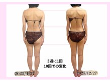 ユルポ(YuREPOS)/40代｜継続10回｜姿勢も改善