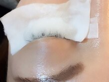 トミー(Tommy)/原因はまつ毛ダニかも！